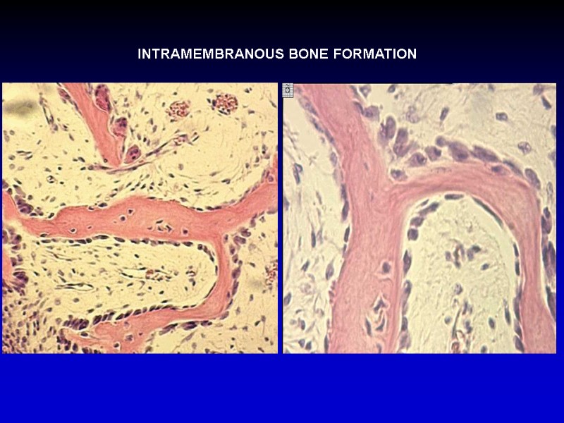 INTRAMEMBRANOUS BONE FORMATION